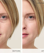 Circle\Delete® Concealer
